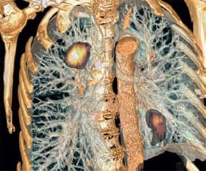 Hibrid görüntüleme